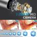 Wireless Earwax Otoscope with Charging Station and 14 Cleaning Tools | 3M High-definition Camera | 3-level LEDs | for iOS & Android - Buy Online on SooperMarket.com