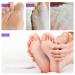 Foot Peel Mask for Exfoliating Calloused Heels - Deep Skin Treatment for Soft and Smooth Feet - Men and Women - Buy Online on SooperMarket.com