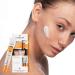 FLOSLEK Spot Face Cream Bleaching Discoloration & Freckles | 20 ml | Reduces Intensity of Redness & Blemishes | Softens & Evens Skin Colour | Healthier & Brighter Complexion | Dermatologically Tested Brightening point cream - Buy Online on SooperMarket.com