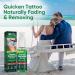 Natural Tattoo Fade Spray for Permanent and Safe Tattoo Removal - Buy Online on SooperMarket.com