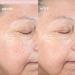 PMD Clean Pro: Smart Facial Cleansing Device & Anti-Aging Massager Blush - Buy Online on SooperMarket.com
