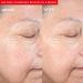 PMD Clean Redvolution - Smart Facial Cleansing Device with Silicone Brush & Red Light Therapy for Smoother Skin Fine Lines Reduction & Firming - Face & Body Care - Buy Online on SooperMarket.com
