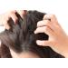 Difeel Peppermint Hot Oil Treatment for Dry Scalp - 7.1 oz | Soothes Irritation & Flakes - Buy Internationally - Buy Online on SooperMarket.com