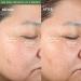 Shop PMD Personal Microderm Clean Smart Facial Cleansing Device - Olive | International Shipping Available - Buy Online on SooperMarket.com