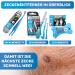 Bluepet 2-in-1 Tick Tweezers for Dogs Cats Horses & Humans - Stainless Steel Tick Remover with Case | Best Alternative to Tick Pliers & Agents - Buy Online on SooperMarket.com