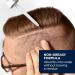 Head & Shoulders Scalp X Minoxidil for Men - Pack of 3 - 2 Fl Oz. - Buy Online on SooperMarket.com