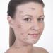 Sandine Pink Cupping Therapy Set for Facial Contouring and Cellulite Reduction - Buy Online on SooperMarket.com