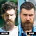 Beard Club Cedar Wood and Lime Beard Balm for Men - Moisturizer, Butter, Softener, Conditioner & Wax - Buy Online on SooperMarket.com
