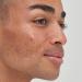 Shop The INKEY List Tranexamic Acid Hyperpigmentation Treatment - 1 oz/ 30 mL Online - Best Price & International Shipping - Buy Online on SooperMarket.com