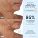 Shop NuFACE Trinity + Wrinkle Reducer Attachment Online - Best Price & International Shipping - Buy Online on SooperMarket.com