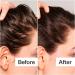 Shop Act+Acre Salicylic Acid Scalp Renew Exfoliator For Oily + Flakey Scalp - 2 oz / 60 ml Online - Best Price & International Shipping - Buy Online on SooperMarket.com