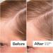 Shop Act+Acre Thick + Full Hair Capsules for Fuller-Looking Hair - 5.3 oz / 150 g Online - Best Price & International Shipping - Buy Online on SooperMarket.com