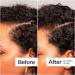 Shop Act+Acre Thick + Full Hair Capsules for Fuller-Looking Hair - 5.3 oz / 150 g Online - Best Price & International Shipping - Buy Online on SooperMarket.com