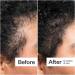 Shop Act+Acre 0.25mm Scalp Dermaroller for Thicker + Fuller Looking Hair - Standard size Online - Best Price & International Shipping - Buy Online on SooperMarket.com