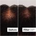 Shop Act+Acre 0.25mm Scalp Dermaroller for Thicker + Fuller Looking Hair - Standard size Online - Best Price & International Shipping - Buy Online on SooperMarket.com