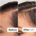Shop Act+Acre 0.25mm Scalp Dermaroller for Thicker + Fuller Looking Hair - Standard size Online - Best Price & International Shipping - Buy Online on SooperMarket.com