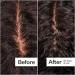 Shop Act+Acre Microbiome Cooling Scalp Serum For Dry Itchy Scalp + Loose Flakes - 2.2 oz Online - Best Price & International Shipping - Buy Online on SooperMarket.com