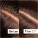 Shop Act+Acre Microbiome Cooling Scalp Serum For Dry Itchy Scalp + Loose Flakes - 2.2 oz Online - Best Price & International Shipping - Buy Online on SooperMarket.com