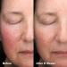 Shop Paula's Choice Skin Perfecting 6% Mandelic Acid + 2% Lactic Acid Liquid Exfoliant - 3 oz Online - Best Price & International Shipping - Buy Online on SooperMarket.com