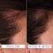 Shop AAVRANI Hair Density Boosting Scalp Serum for Thinning Hair & Hair Loss - 2 oz / 60 ml - 4 Month Supply Online - Best Price & International Shipping - Buy Online on SooperMarket.com