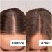 Shop Act+Acre Daily Hydro Scalp Serum with Hyaluronic Acid for Dry Scalp - 1 oz / 30 mL Online - Best Price & International Shipping - Buy Online on SooperMarket.com