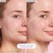 Shop Glow Recipe Blackberry Retinol Blemish Serum - 1 oz / 30 ml Online - Best Price & International Shipping - Buy Online on SooperMarket.com