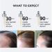 Shop COLOR WOW Youth Juice Collagen Scalp Serum for Thinning Hair - 1.7 oz / 50 mL Online - Best Price & International Shipping - Buy Online on SooperMarket.com